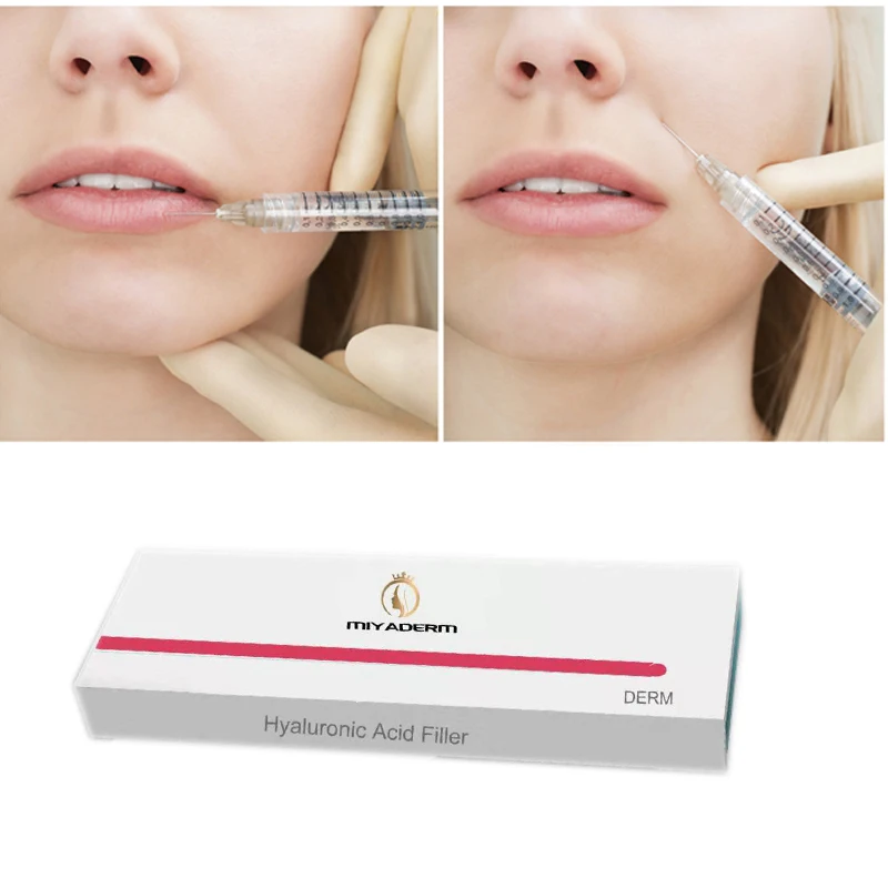 

Hyaluronic acid derm 1ml nasolabial folds forehead lines