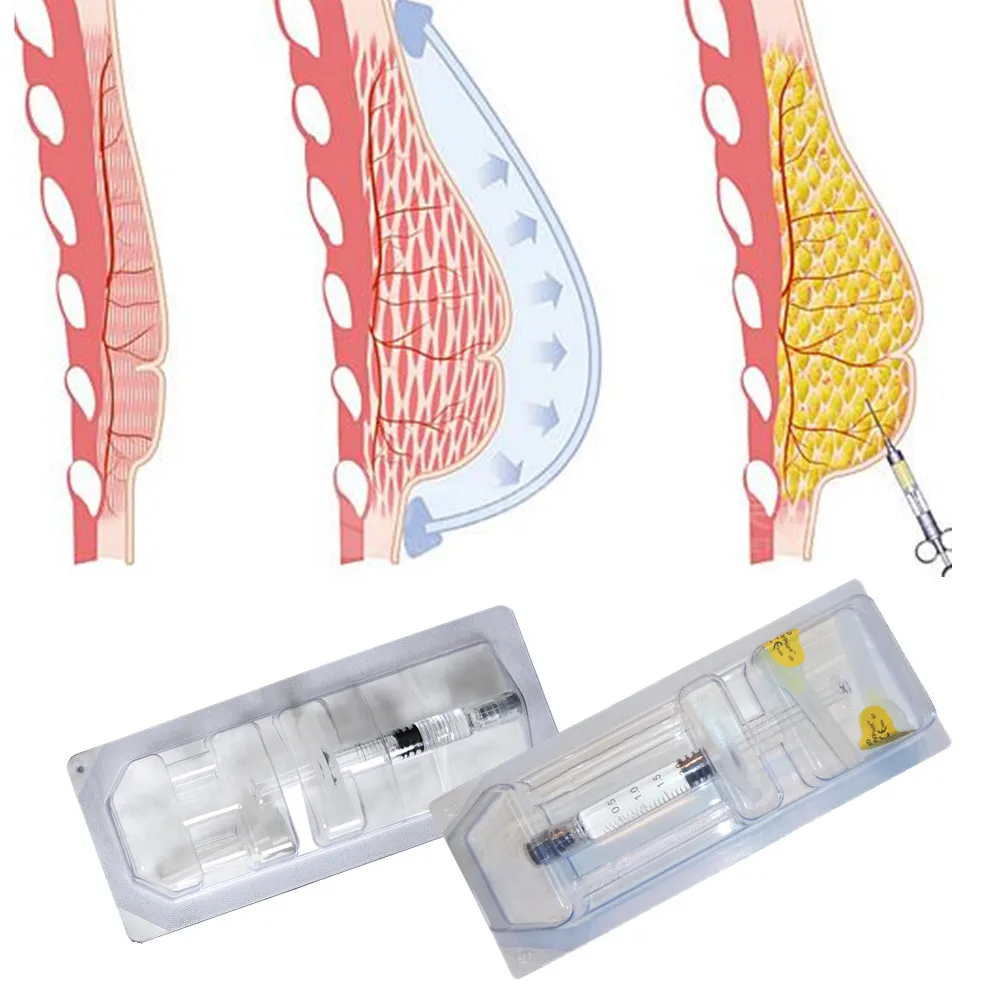 

dermal filler injection butt enlargement / hydrogel injections, Transparent