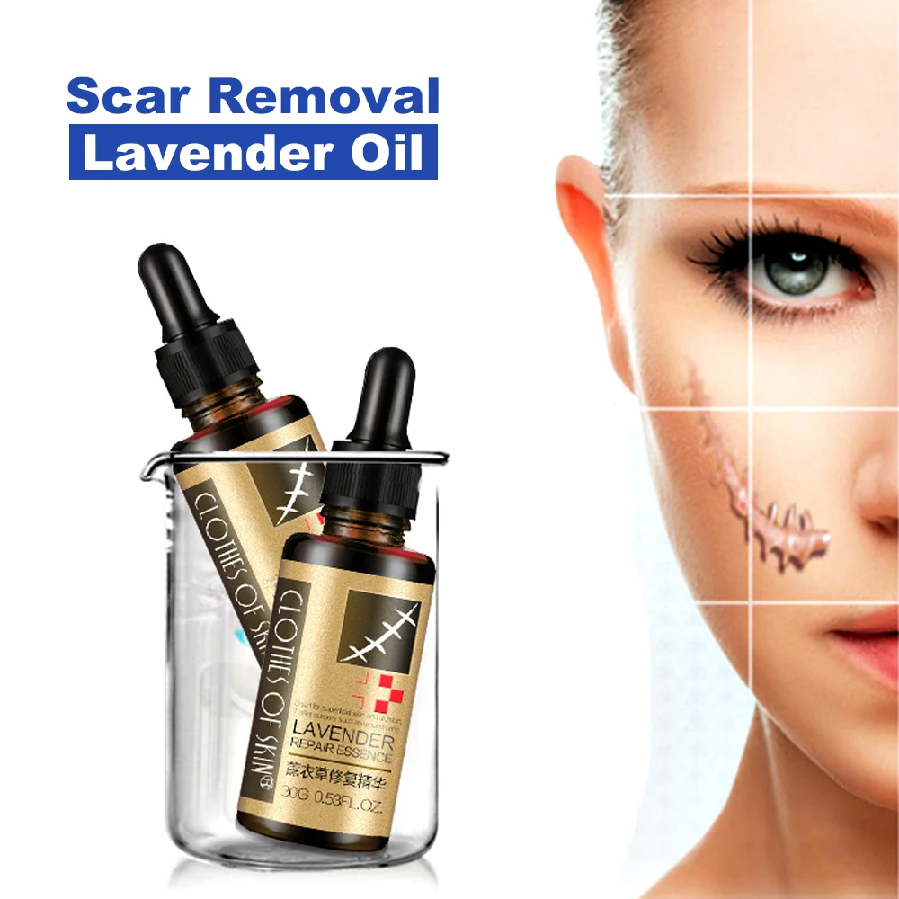 

Essential Massage Oils Scar Removal Lavender Essence For Pregnant Women Hyaluronic Acid Serum Oil Essential Face Anti Acne