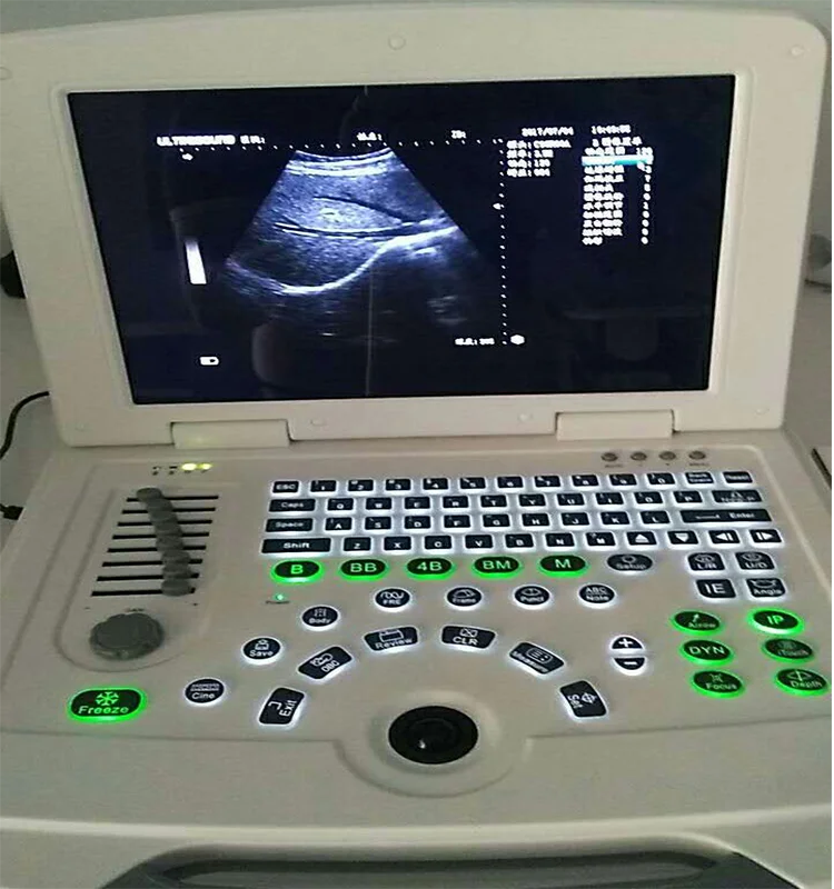 Medical Portable Digital B Mode Laptop  Ultrasound Scanner hospital machine