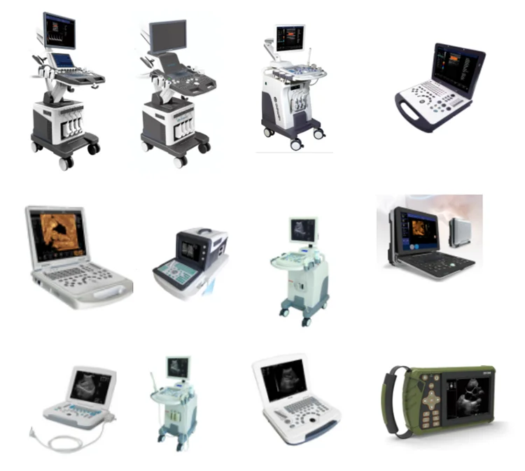 Portable medical equipment mobile computer ultrasound machine with all kinds of probe in hosital