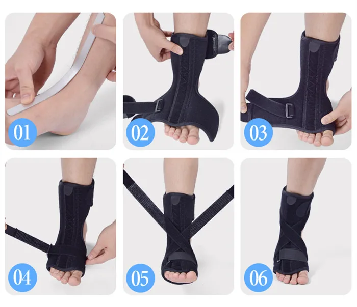 plantar fasciitis (13).jpg