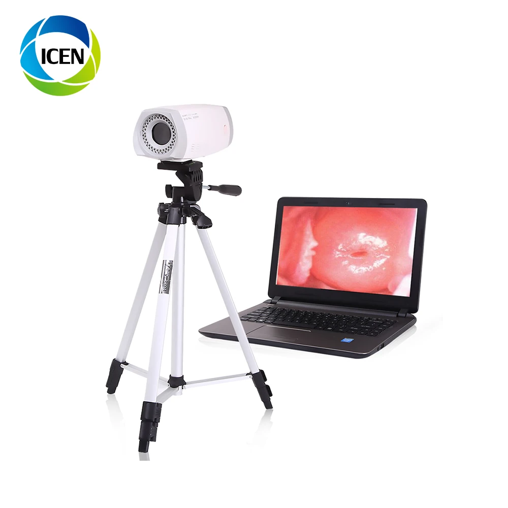 hd vagina colposcope