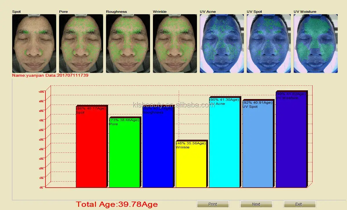 Анализ кожи. Skin age Test.