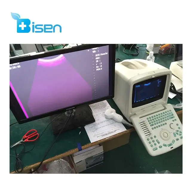
Cheap powerful function ultrasound scanner with convex array probe pretty and portable appearance 