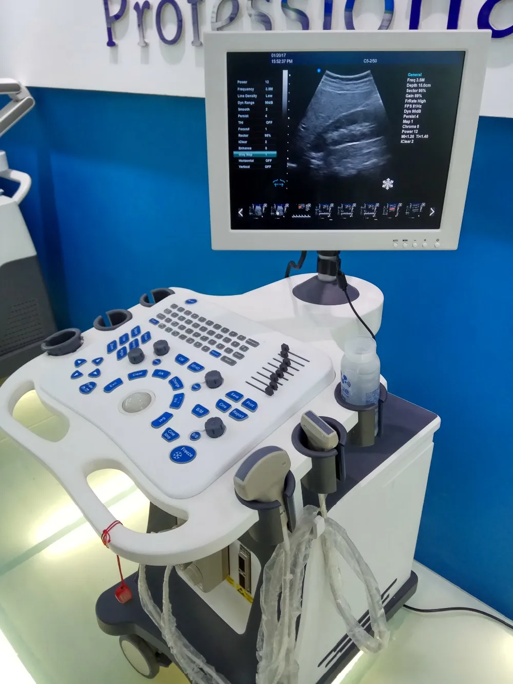 colour doppler ultrasound pregnancy in hindi manufacturers