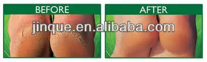 foot care products