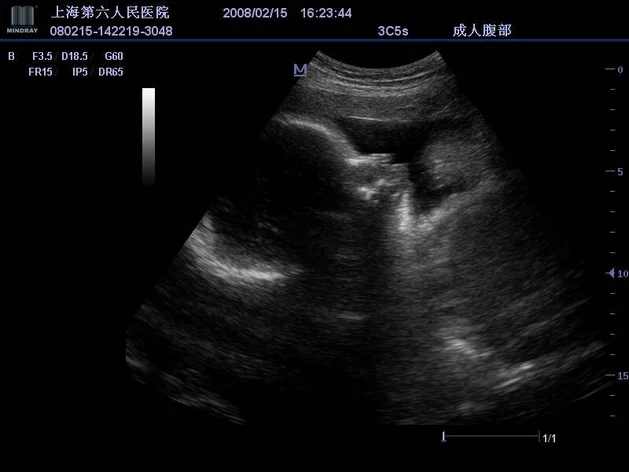 Portable 3D Doppler Ultrasound Machine Ultrasonography