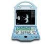 /product-detail/odu5-china-portable-ab-ultrasound-scanner-handheld-eye-ultrasound-scanner-60678432913.html