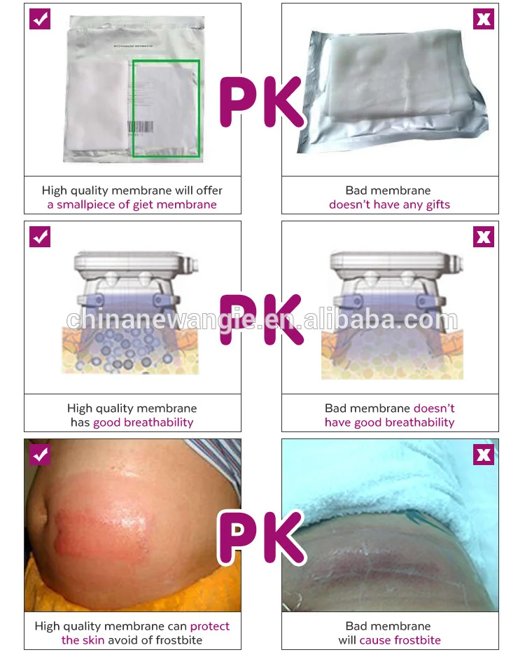 cryolipolyse slimming machine