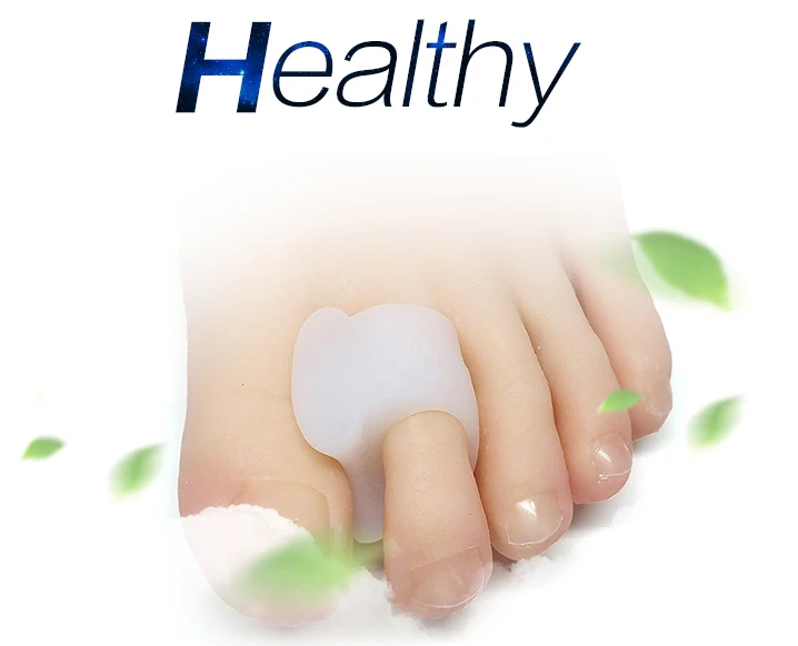 bunions on feet