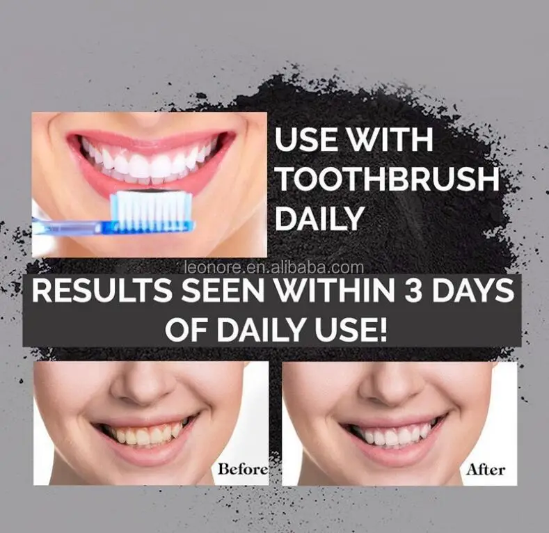Teeth whitening 20.jpg