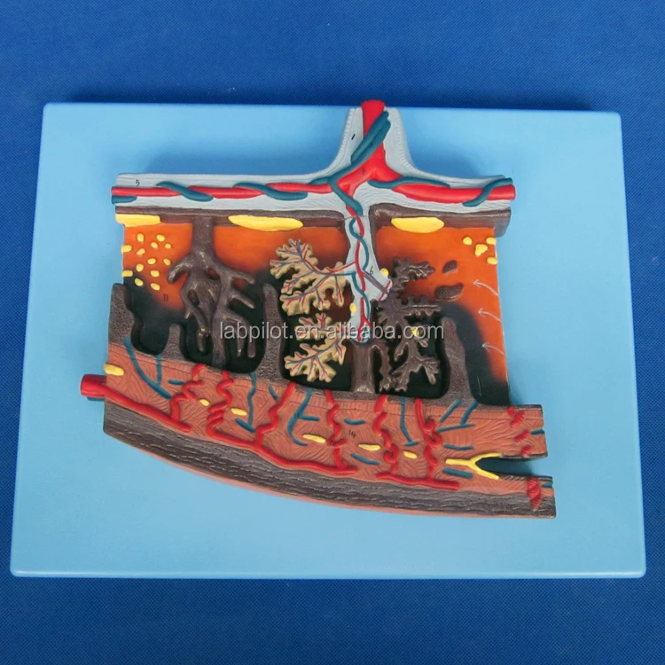 A42010-2 placenta (2).JPG