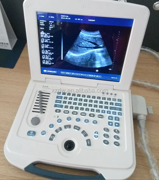 Dw580 Fulldigital Cheap Laptop Ultrasound Machine With Lithium Battery