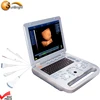 Laptop OB and GYN professional software 3d 4d ultrasound