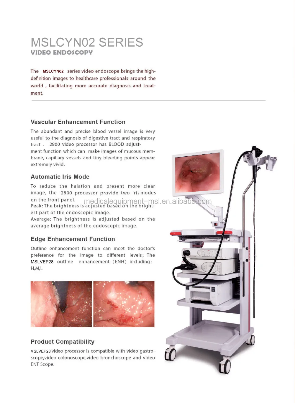 Mslcyn02 High Resolution The Whole Set Endoscopy Machine With Flexible