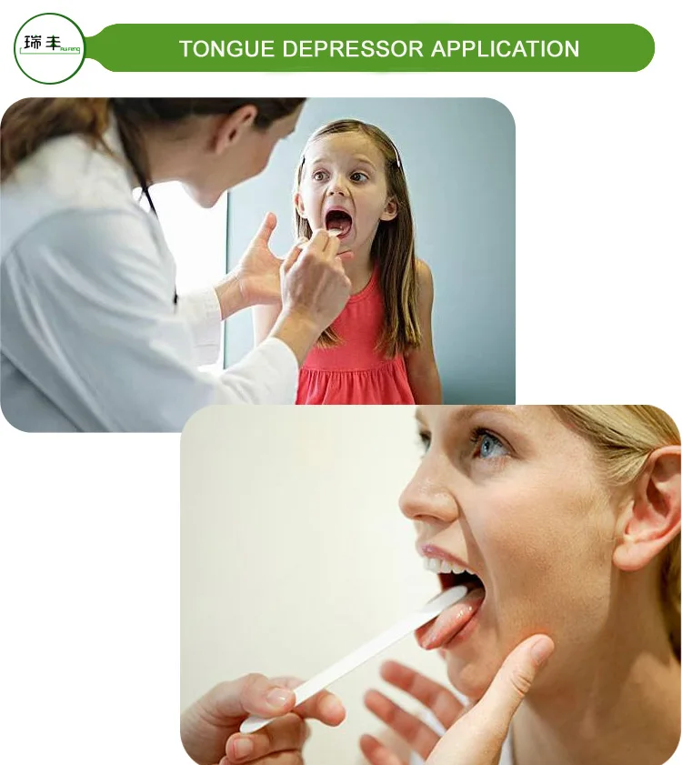 Non Sterile tongue depressors