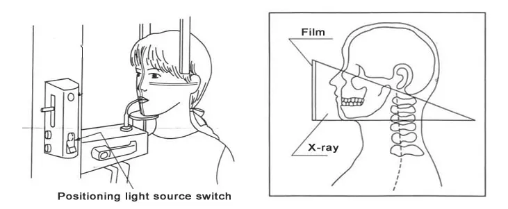 x-ray-machine.jpg