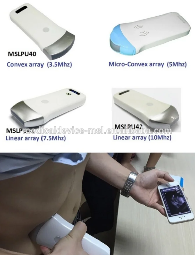 High Frequency 10mhz Linear Array Wifi Ultrasound,Multifrequency 5