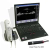 Portable ophthalmic A B scan ,Optical UBM connect to computer