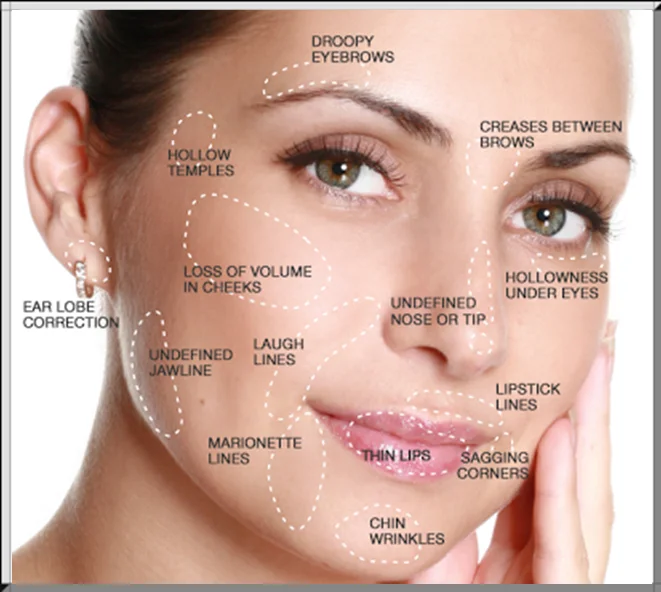 under eye wrinkle filler cream
