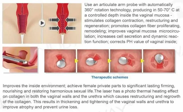 Fractional co2 laser beauty equipment vaginal tightening skin resurfacing fda co2 fractional laser
