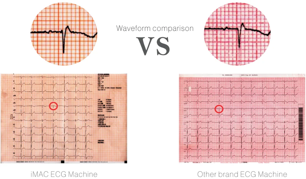 6 Channel Built In Scanning Gun Handheld Digital System ECG Machine With WiFi