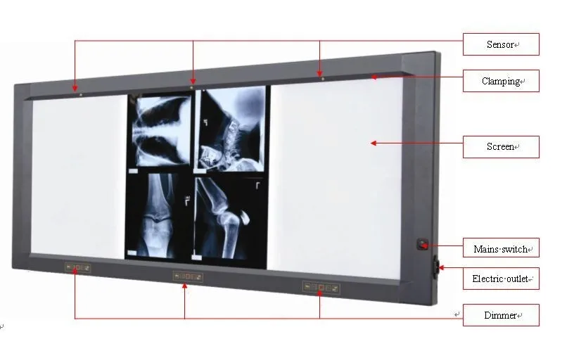 Устройство для просмотра рентгеновских снимков черно белых. Экран для просмотра рентгеновских снимков. Монитор для просмотра рентген снимков. Рентгеновский светодиод. Панель для просмотра рентгена.