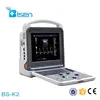 Handheld notebook manufacturing ultrasound machine with various functions and excellent image quality for cardiac