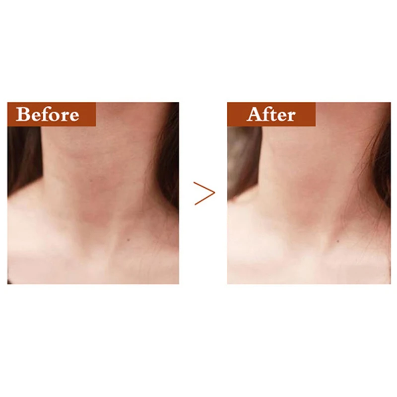 Anti Aging Serum Goat Milk Neck Mask Anti Wrinkle Neck Cream Firming Whitening Neck Cream Skin Care Lifting Firming Moisturizing