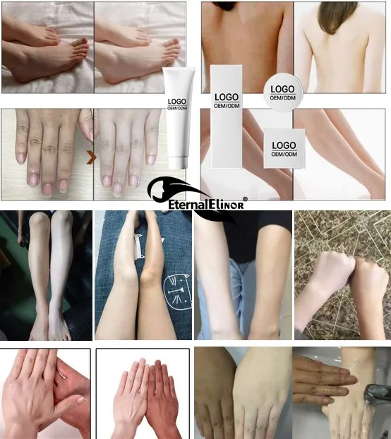 

2017 High Quality Dark Black Skin Whitening Bleaching Cream, Milk white