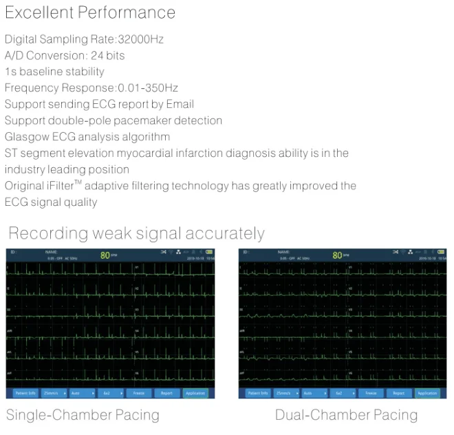 Portable 12 Channel ECG machines mac compatible