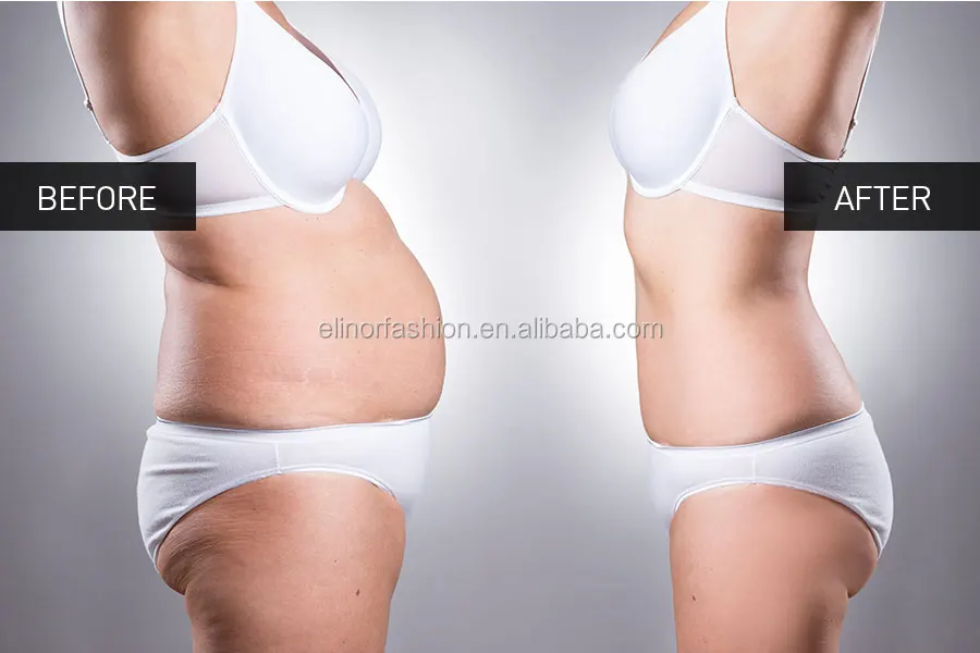 before_after_slimming