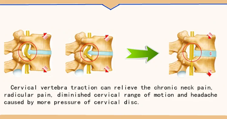 家庭使用骨科可调颈椎拖拉机领