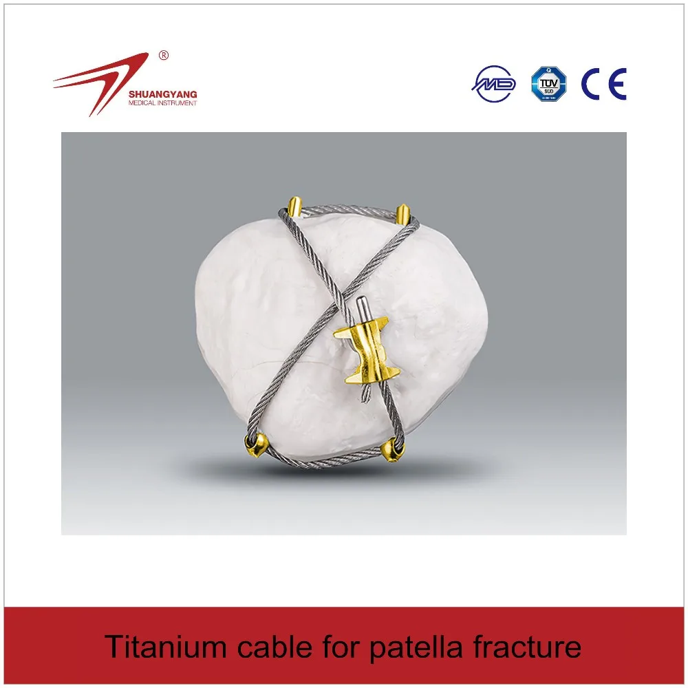 Titanium cable for patella fracture