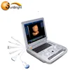 urology medical 3d ultrasound convex linear probe