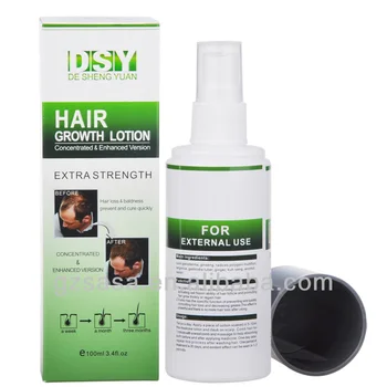 Hair Solution For Hair Loss - fashionnfreak