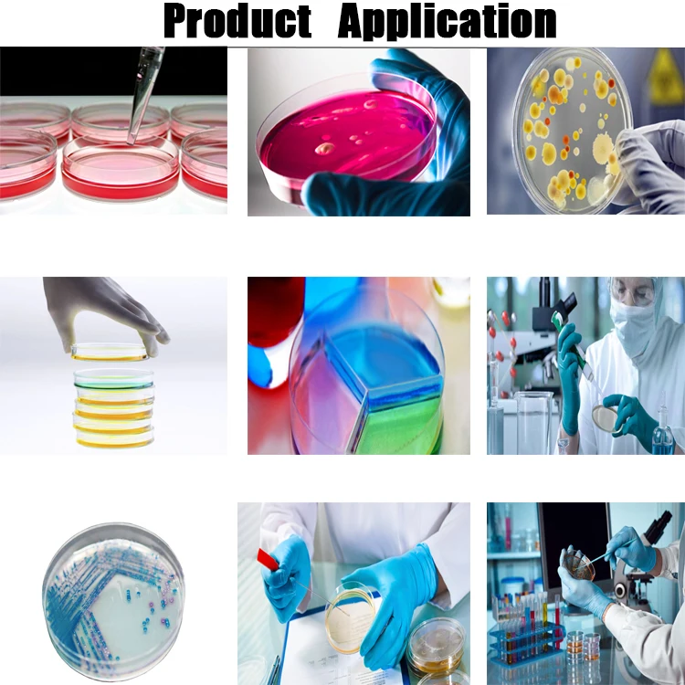 Hot sale disposable medical sterile 150mm plastic petri dish