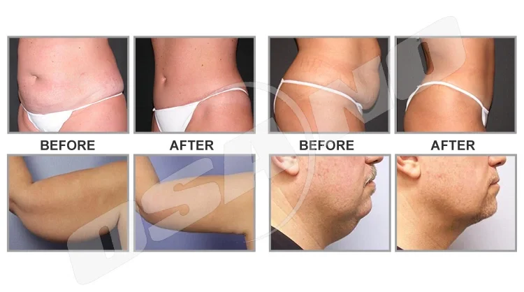 Моментальный загар near me in Smolensk: ★ locations, opening hours, and reviews 