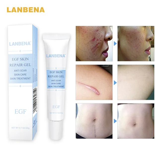 

LANBENA EGF Remover Scar Cream Stretch Mark Gel Anti Acne Cream Acne Treatment Blackhead Whitening Skin Care Repair Face Cream