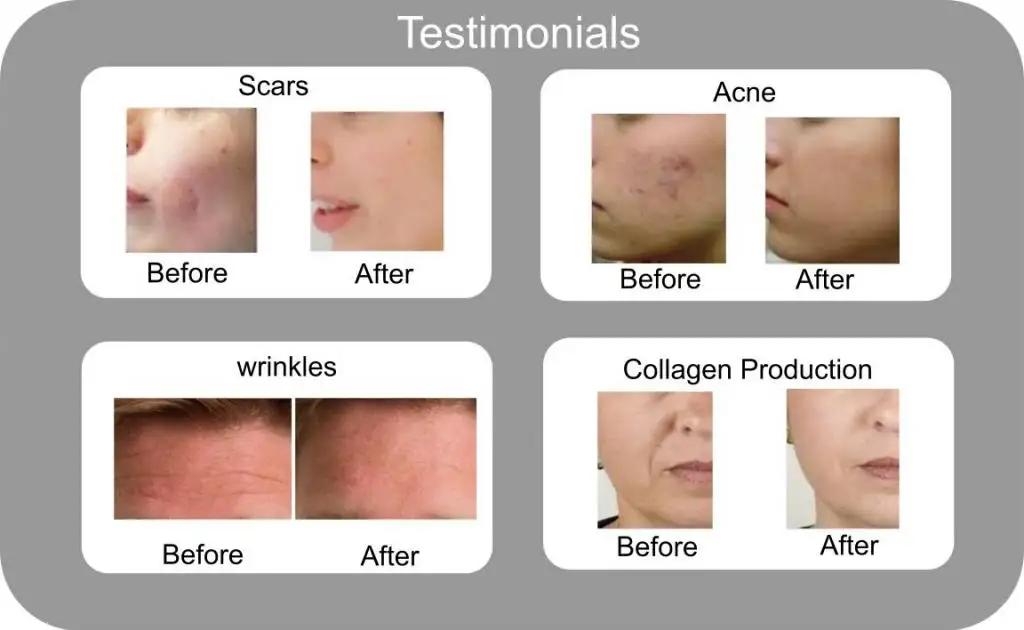 100 Natural Cosmetic Ingredient Snail Slime Extract