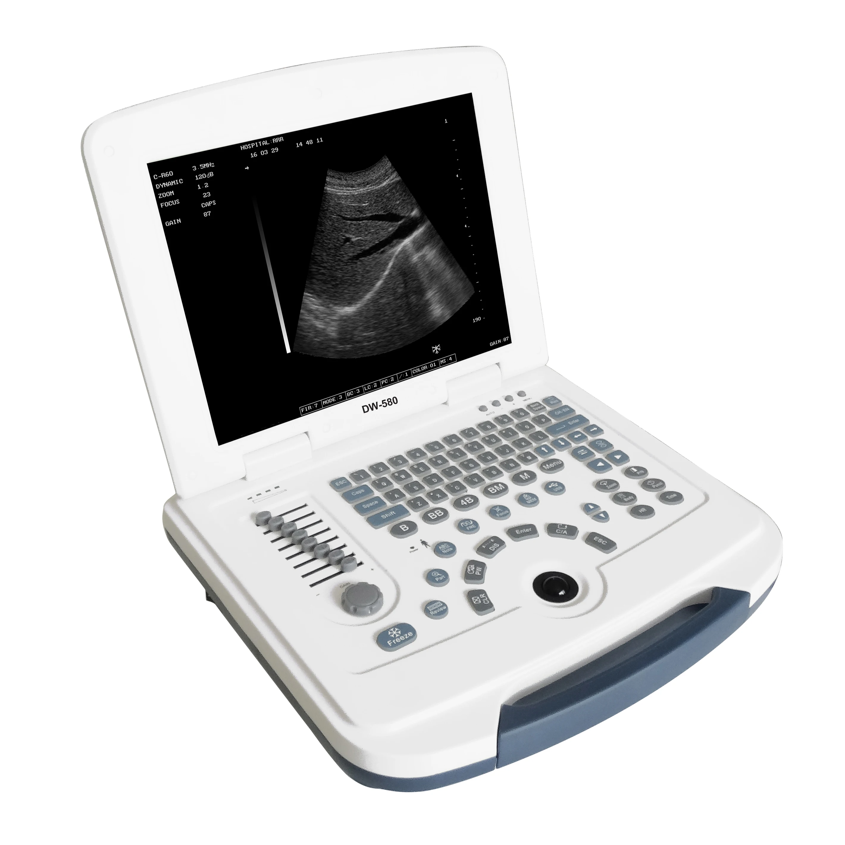 China Hot Selling Notebook Digital Diagnostic 12inch LCD Display Ultrasound Scanner with batarry DW-580 Price
