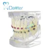 competitive price orthodontic model for showing premolar extracted with bracket and ligature wire affixed