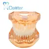 Fantastic Quality Dental Model, Soft Gum with Removable Teeth without Hinge