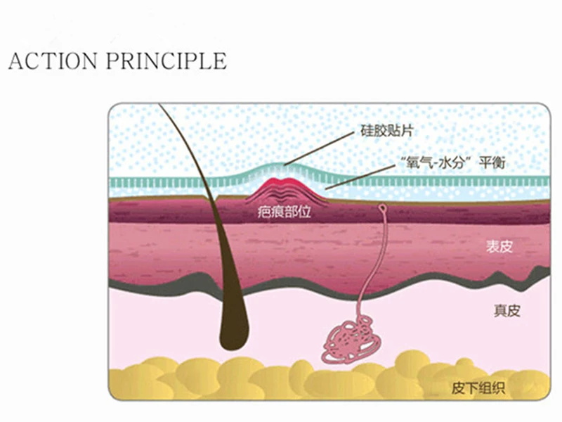 silica gel scar sheet
