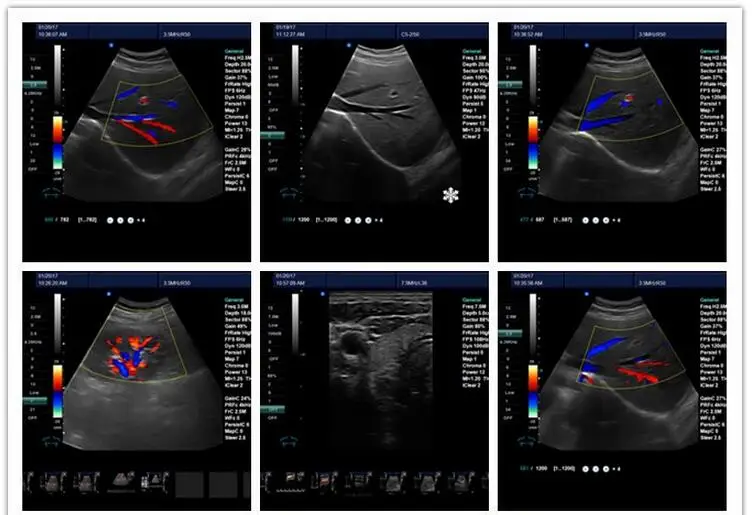 Doppler Ultrasound Equipment Type 3D/4D Portable Color Doppler Ultrasound System