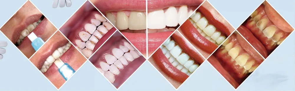 Personal Dental Care 1 minute dental care