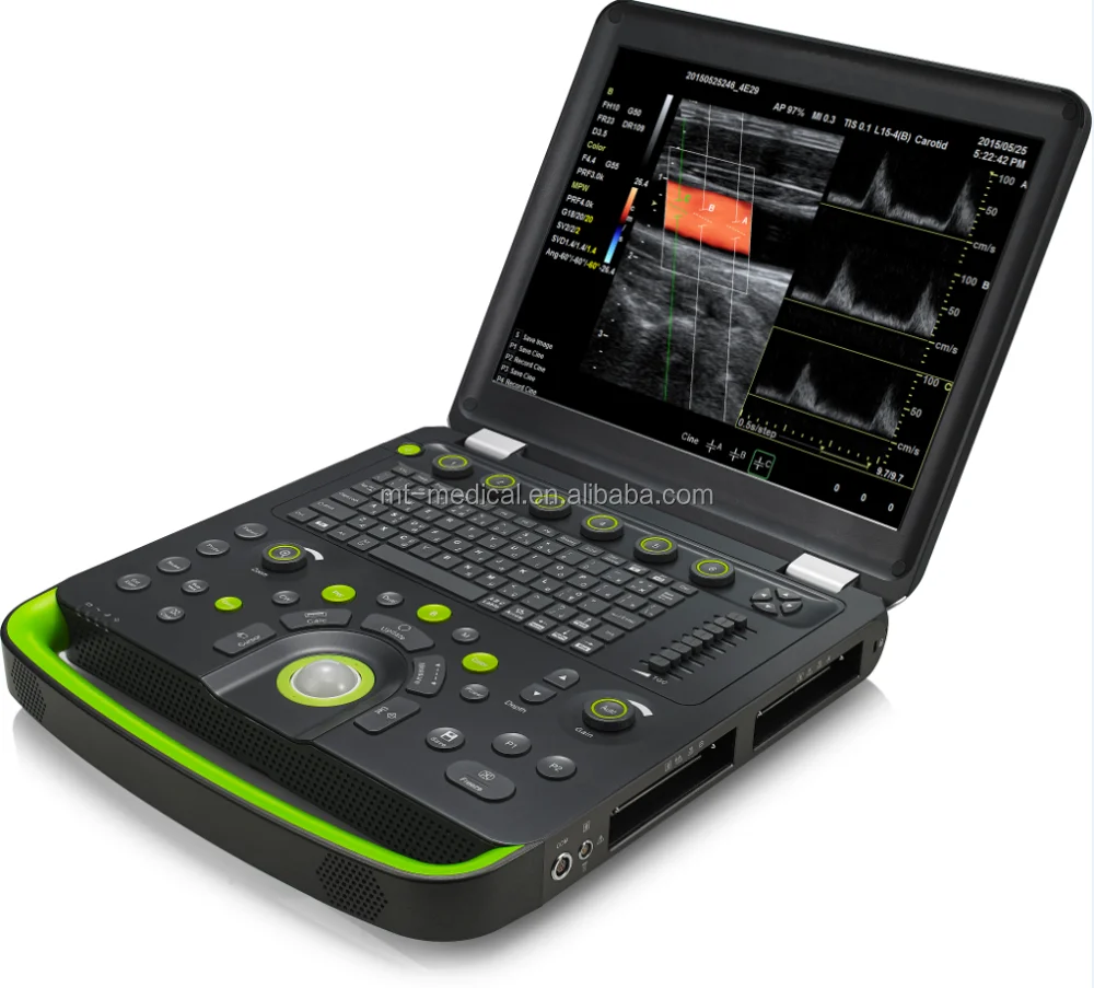 2017 New Portable Laptop Ultrasonic Diagnostic Devices Type ultrasound machine
