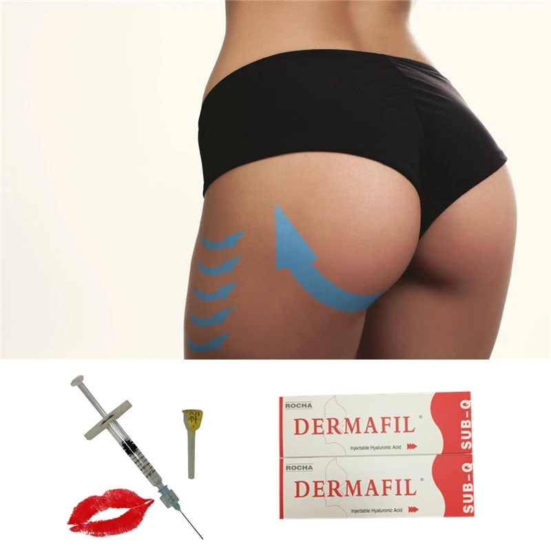 

10.0 ml Dermafil buttock lift Enhancement fillers