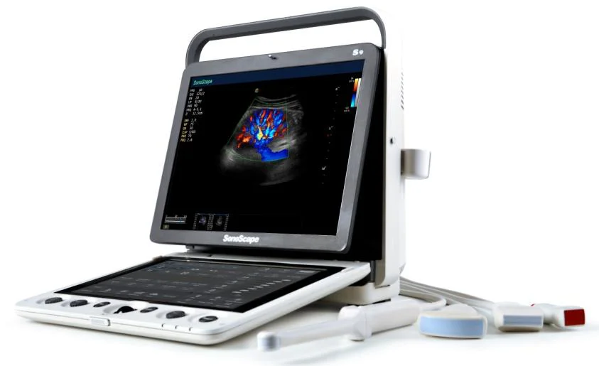 Лучшие аппараты узи. SONOSCAPE s9pro. SONOSCAPE x5. Portable Digital Color Doppler Ultrasound System s9. Mindray z 60 z50.